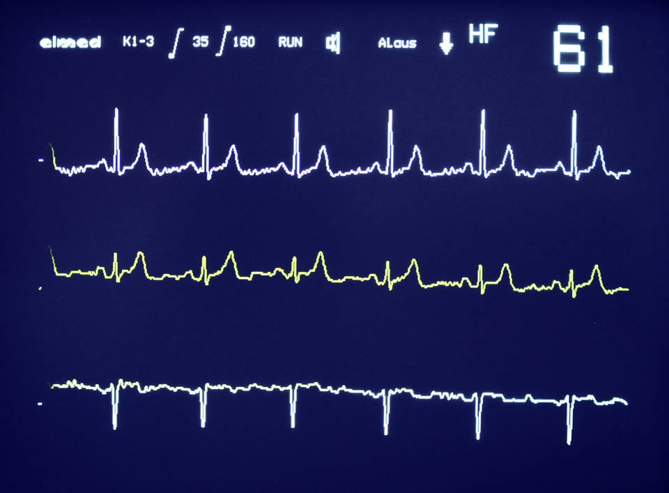 kardiologie