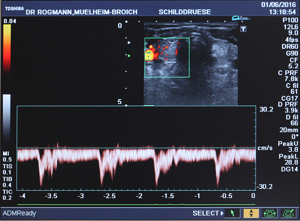 Ultraschall Monitor